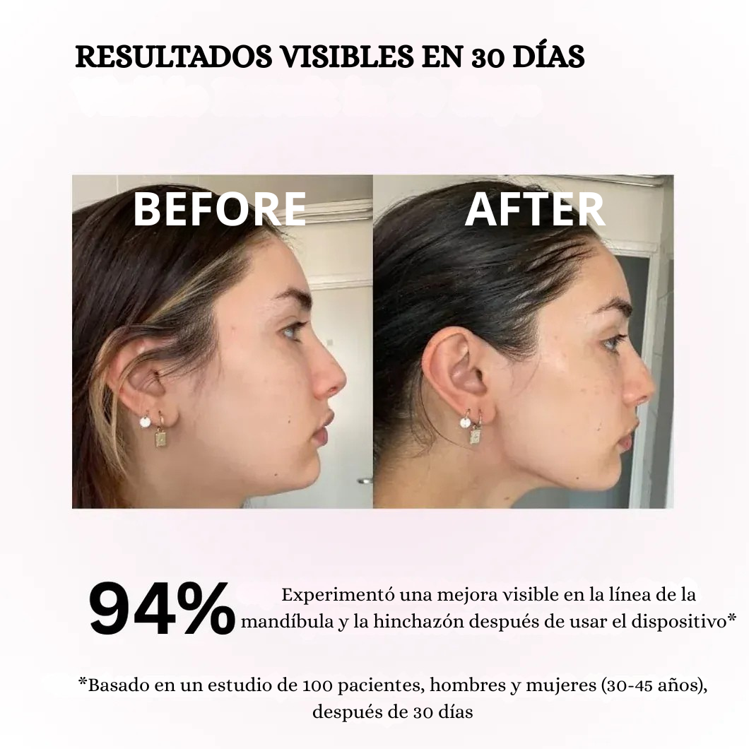 Lusimé - Masajeador Facial EMS